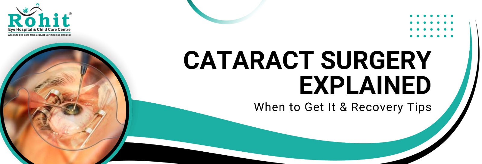 cataract surgery in Indore